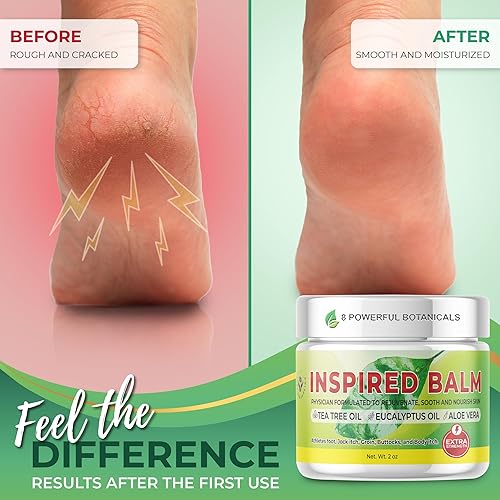 Miniatura 2 de Inspired Balm, bálsamo de aceite de árbol de té de acción rápida, formulado por médicos con potentes ingredientes vegetales, crema de picor jock,