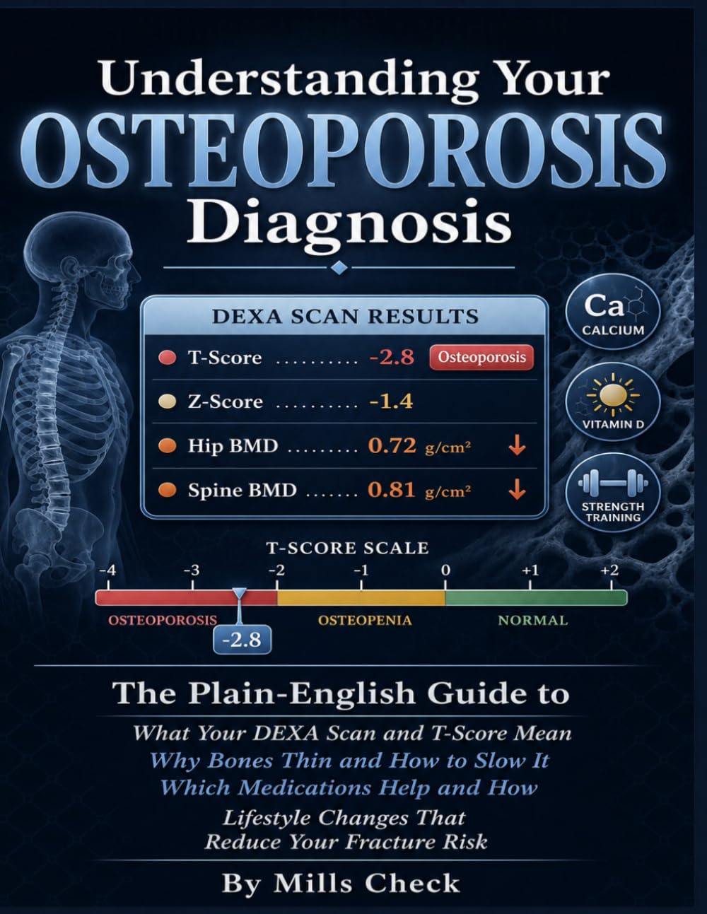Understanding Your Osteoporosis Diagnosis: The Plain-English Guide to What Your DEXA Scan and T Score Actually Mean — Why Bones Thin, Which Medications Help and How They Work, What Lifestyle Changes.