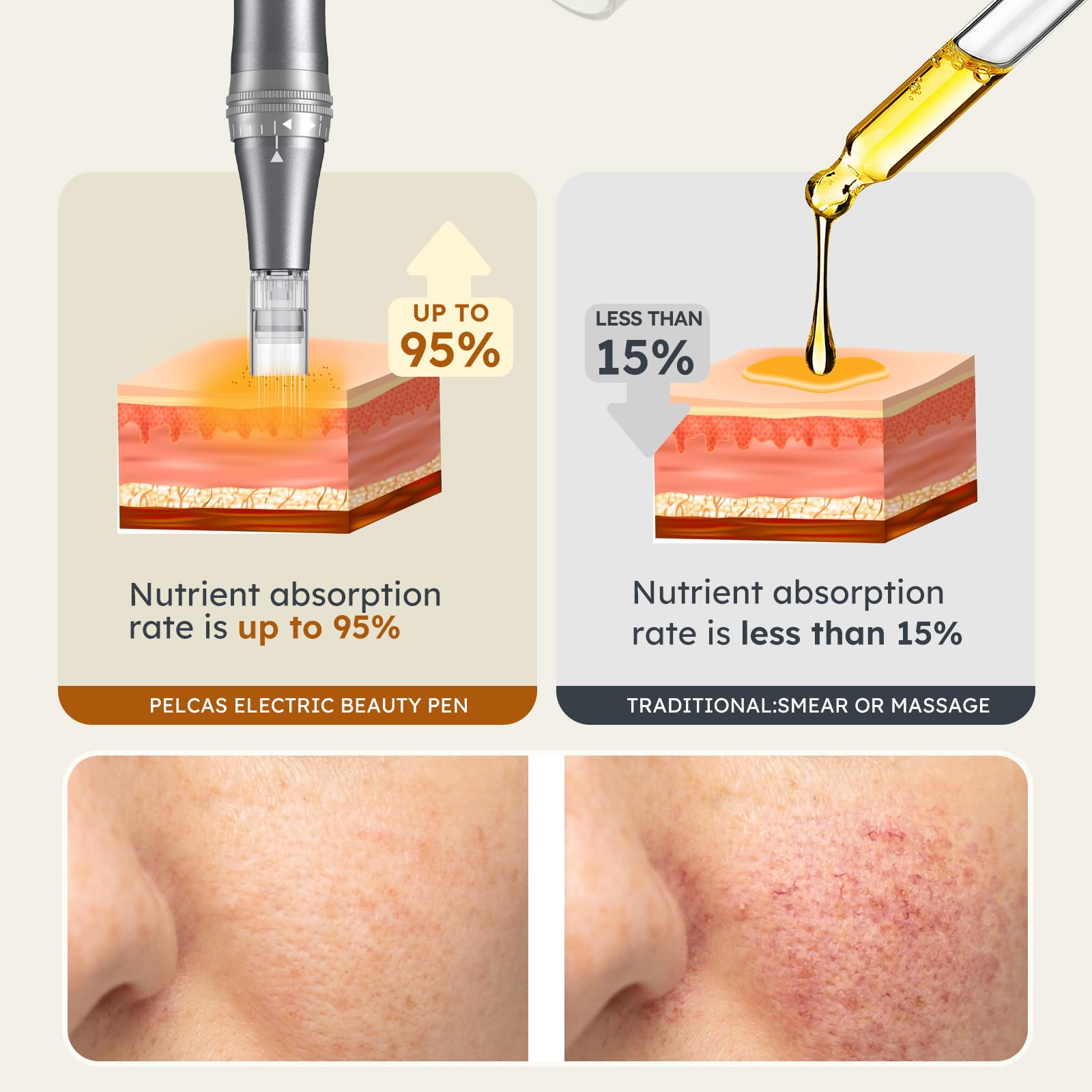 9 Vitesses Stylo Beauté Microneedling, PELCAS Appareil de Soin du Visage et du Corps avec Écran LCD et 12 Embouts, Réglage Personnalisé