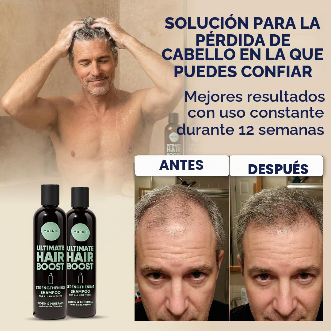 Moerie Ultimate champu de cabello crecimiento – pelo Grueso y Abundante - Shampoo Anticaída Mujer – Producto voluminizante - vegano - sin parabenos ni silicona - todo tipo de cabello – 250 ml X2
