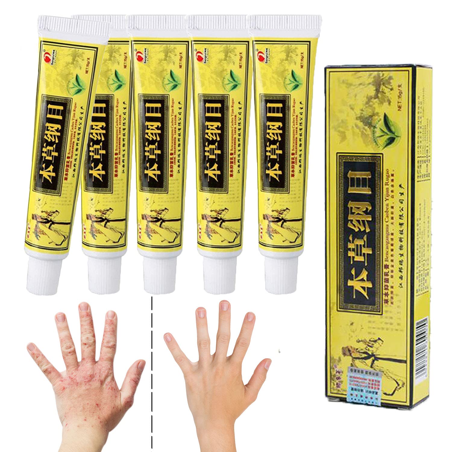 5pcs/Lot Chinese Herbal Eczema, Psoriasis Creams Dermatitis and Eczema Pruritus Psoriasis CEZUBEM Ointment
