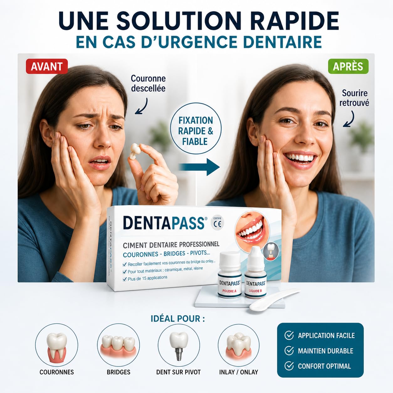 Ciment Dentaire | Colle Dentaire Pour Couronne, Bridge, Dent sur Pivot | Qualité Professionnelle | 15 Utilisations | Application Facile | Certifié CE | Entreprise FR