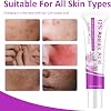 2 Pcs 12% Azelaic Acid Cream,Rosacea Cream for Face,Revitalize Your Complexion Facial Serum,Gentle and Moisturizing for all Skin Pigmentation Redness