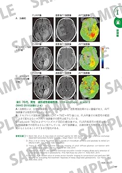 MRI一問一答: 撮像法選択と読影に“必ず”役立つ基礎知識 (Gakken