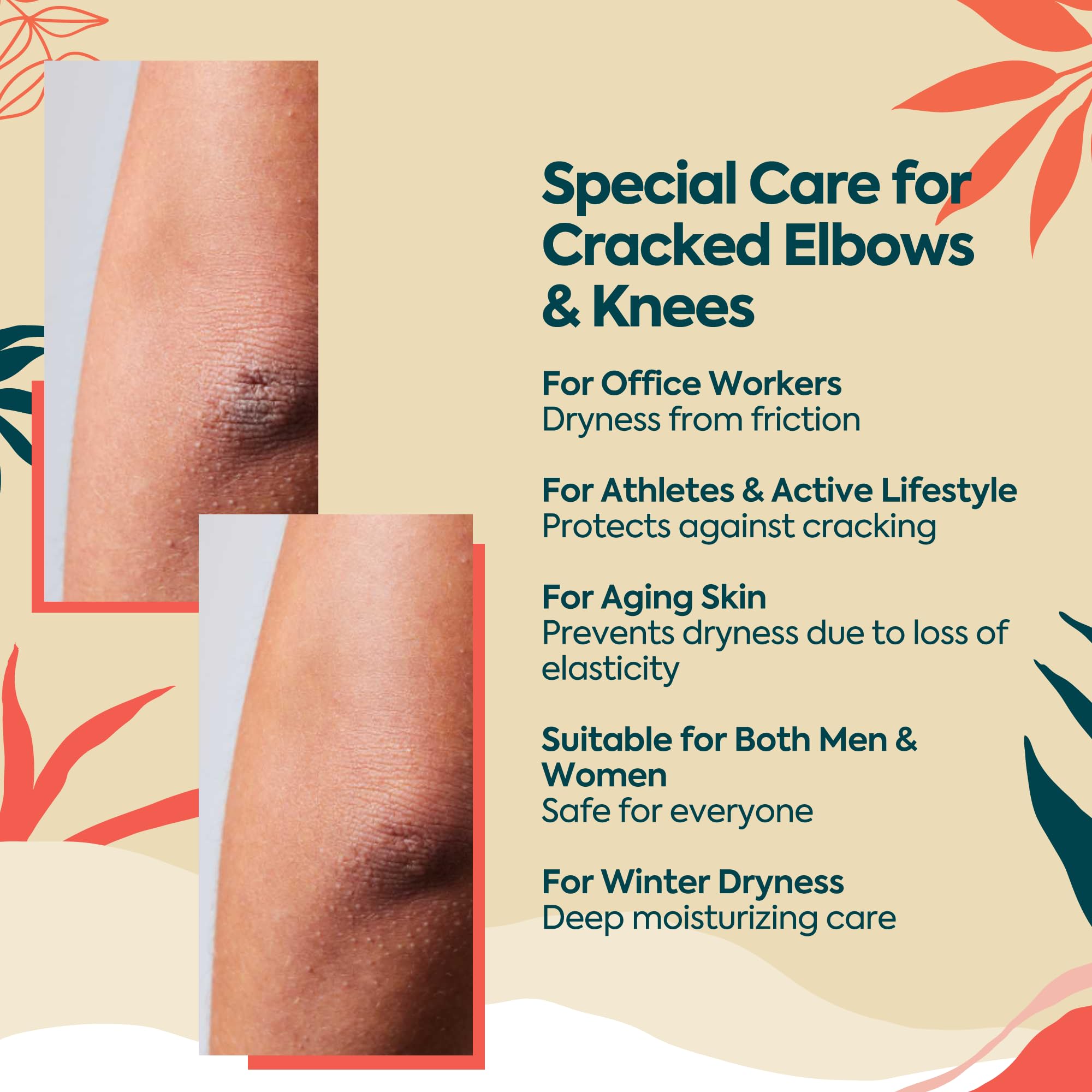CLASYCARE Dirsek ve Diz Çatlak Onarıcı Krem – Yoğun Nemlendirici & Ölü Deri Temizleyici – Hindistan Cevizi Yağı & Seramid ile Kuru, Sert, Koyu Renkli Cilt Onarımı – Tüm Cilt Tipleri, 100 ml