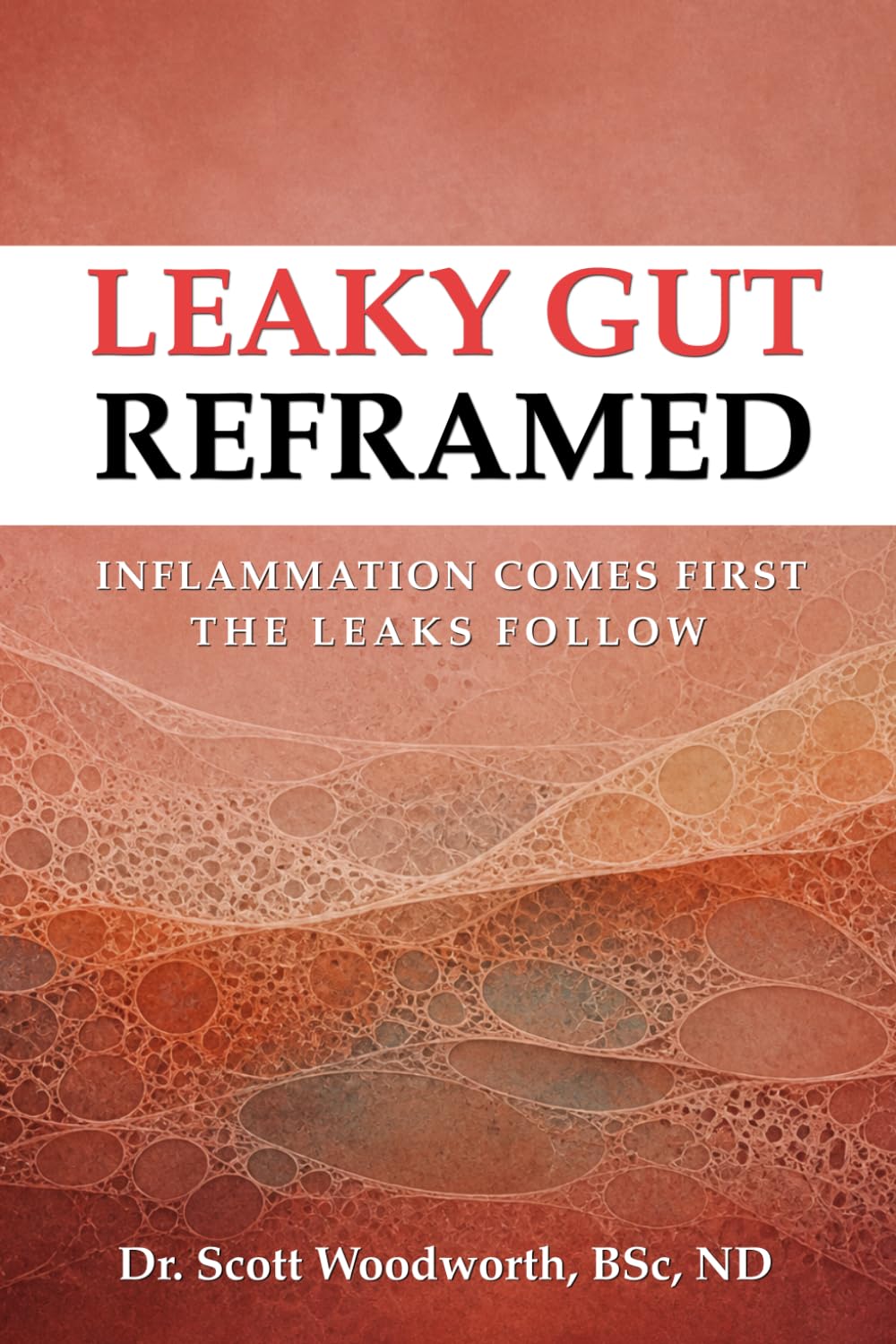 Leaky Gut Reframed: Inflammation Comes First, The Leak Comes Second (Chronic Inflammation and your Diet)