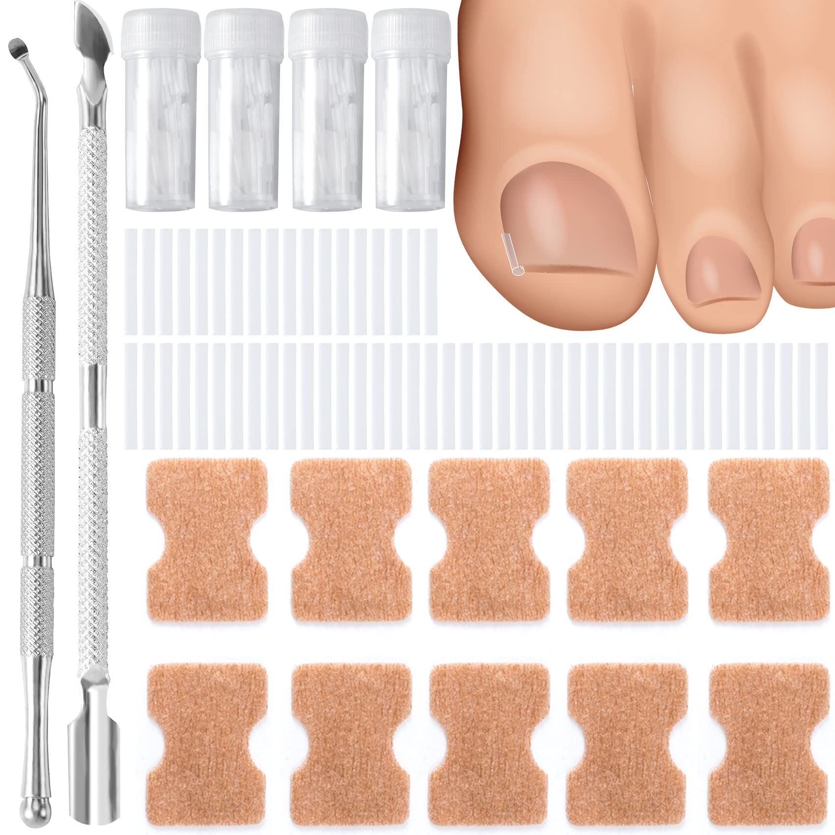 PAGOW 200+30+1+1 Ingrown Toenail Removal Tool, Correction Kit Pedicure Tool, Nail Lifter Set, Nail Filler Pad