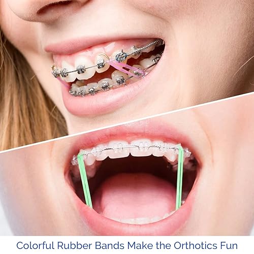 Miniatura 6 de JMU Bandas de goma de ortodoncia 14 medianas de 0.252 in transparentes de ortodoncia elásticas, 4.5 onzas, paquete de 500 bandas de goma dentales