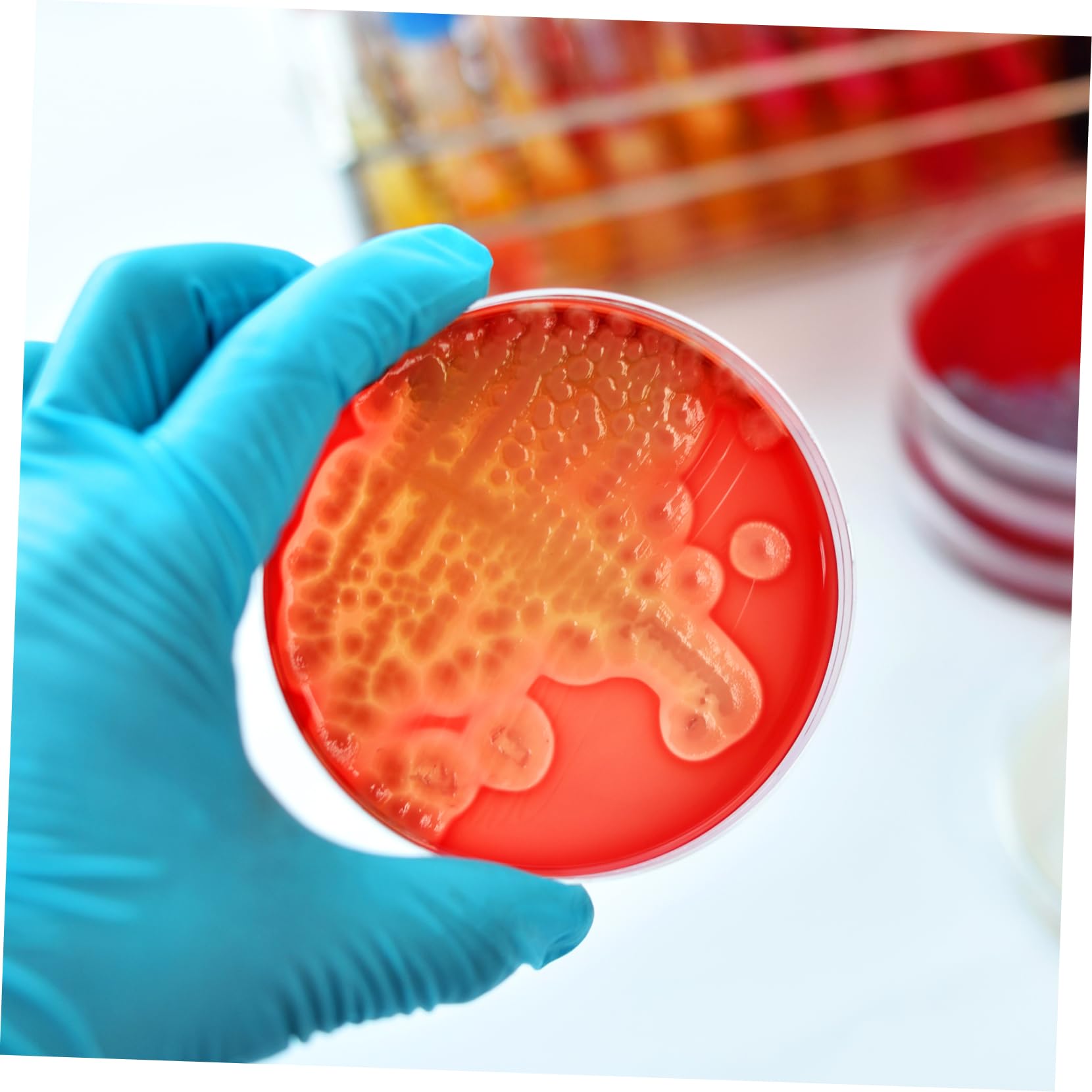 Vorgegossene Agar-petrischalen 20-teiliges Set 7 Cm Nähragarplatten Einfach Zu Verwendendes Wissenschaftliches Laborzubehör