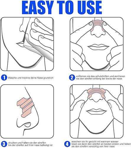 Miniatura 5 de Anomidry Dispositivos anti ronquidos 150 tabletas especiales para la respiración nasal de PCST dejan de roncar y alivian la congestión nasal causada