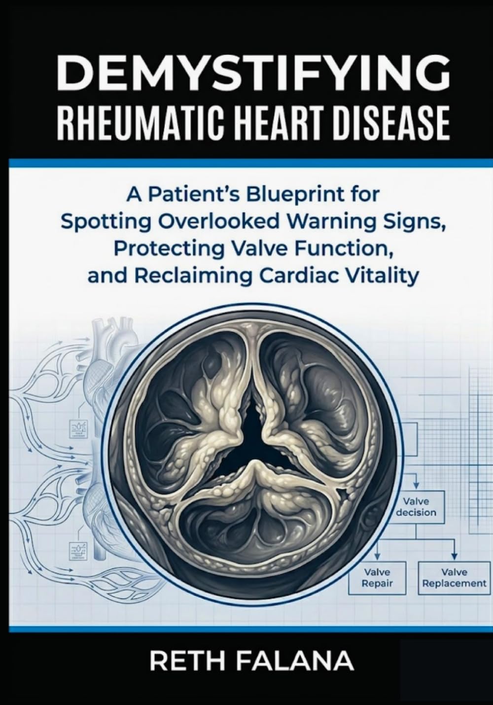 Demystifying Rheumatic Heart Disease: A Patient’s Blueprint for Spotting Overlooked Warning Signs, Protecting Valve Function, and Reclaiming Cardiac ... Guide Series: The Heart Conditions Explained)