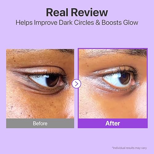 Miniatura 4 de numbuzin No.9 NAD+ Retinol Crema de ojos, Suero de ojos desinflamante y reafirmante para ojeras, arrugas y líneas finas, Péptidos y Niacinamida para