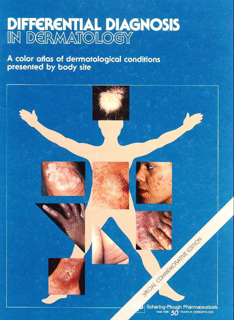 Differential Diagnosis In Dermatology, A color atlas of dermatological