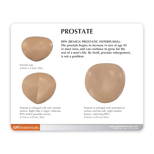 Miniatura 3 de Macho Pelvis con 3d próstata marco  GPI Anatomicals macho Pelvis con 3d próstata marco