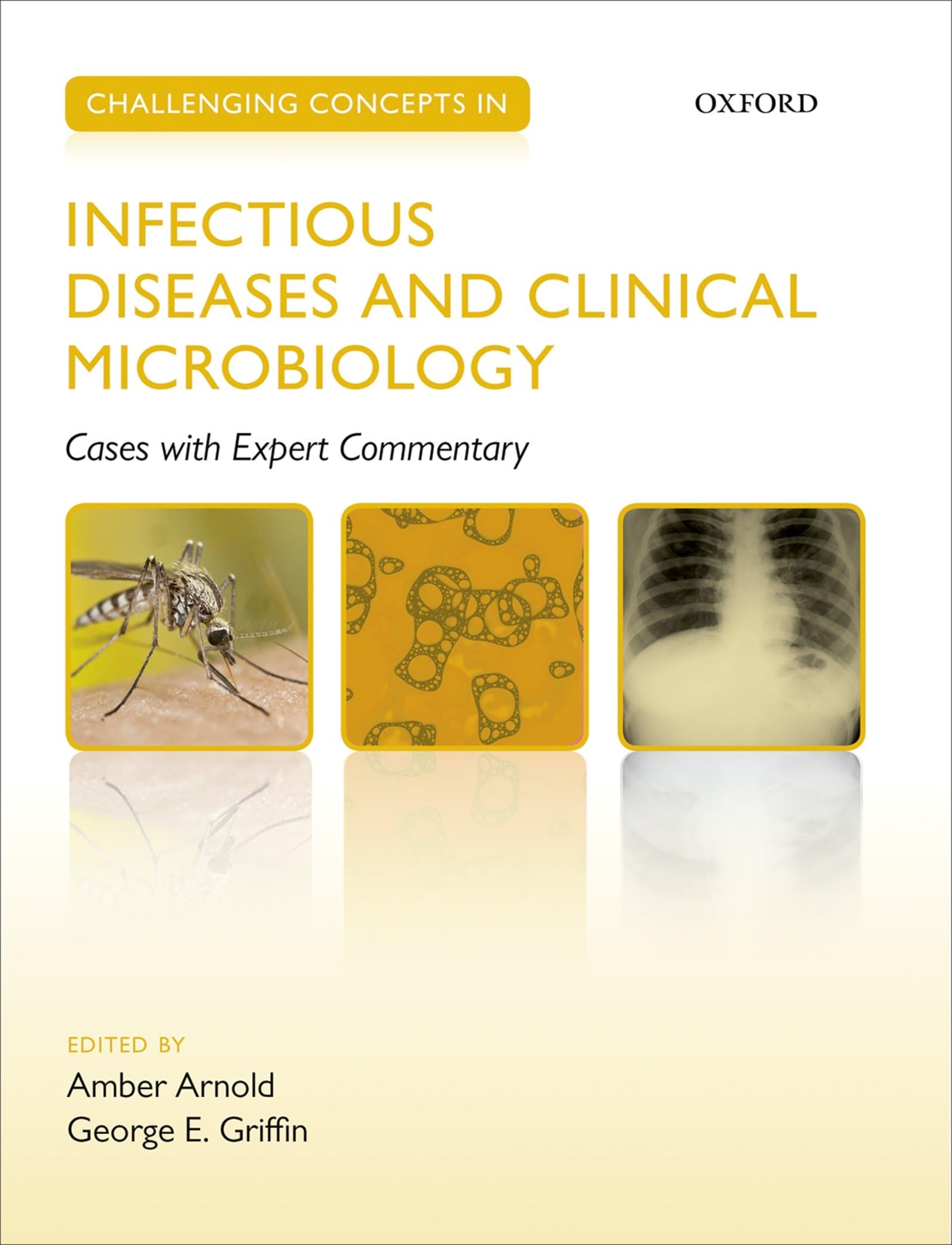 Challenging Concepts in Infectious Diseases and Clinical Microbiology: Cases with Expert Commentary (Challenging Cases)