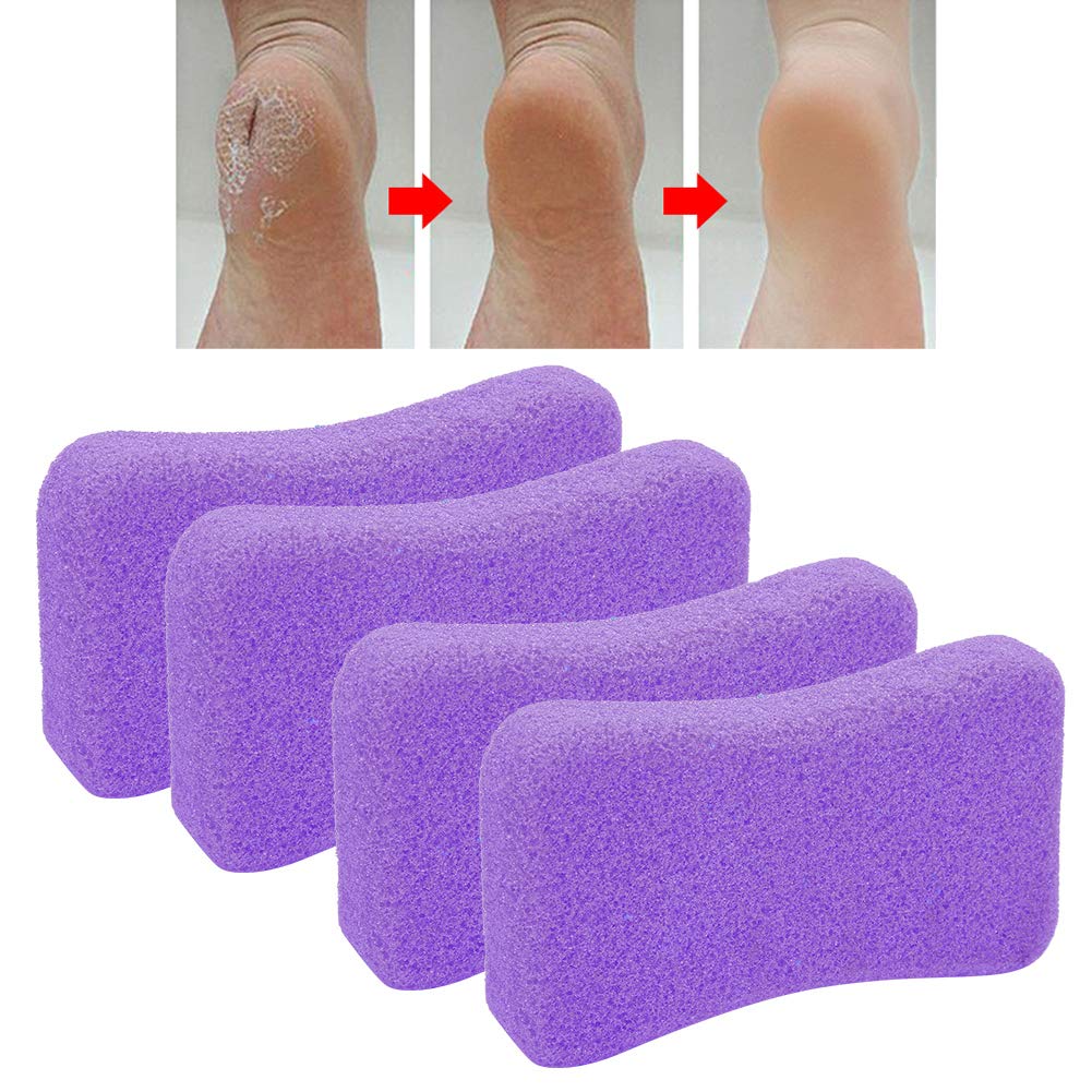 Piedi Pietra pomice - 4 pezzi Cura dei piedi Callus Pietra esfoliante Piedi Pelle dura Rimuovi pedicure Scrubber(Viola)