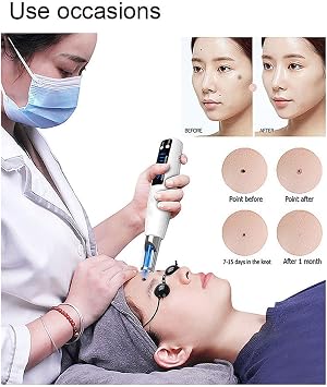 Picosecond Pen Plasma Device Freckle Scar Tattoo Removal Dark Spot Removal Machine, 9 Modes + 4 Levels, LCD Display, with Glasses(Red)