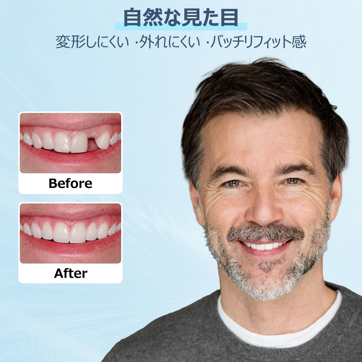 Amazon.co.jp: Dentellea カスタム 入れ歯 部分 義歯 飲食可能 自然な