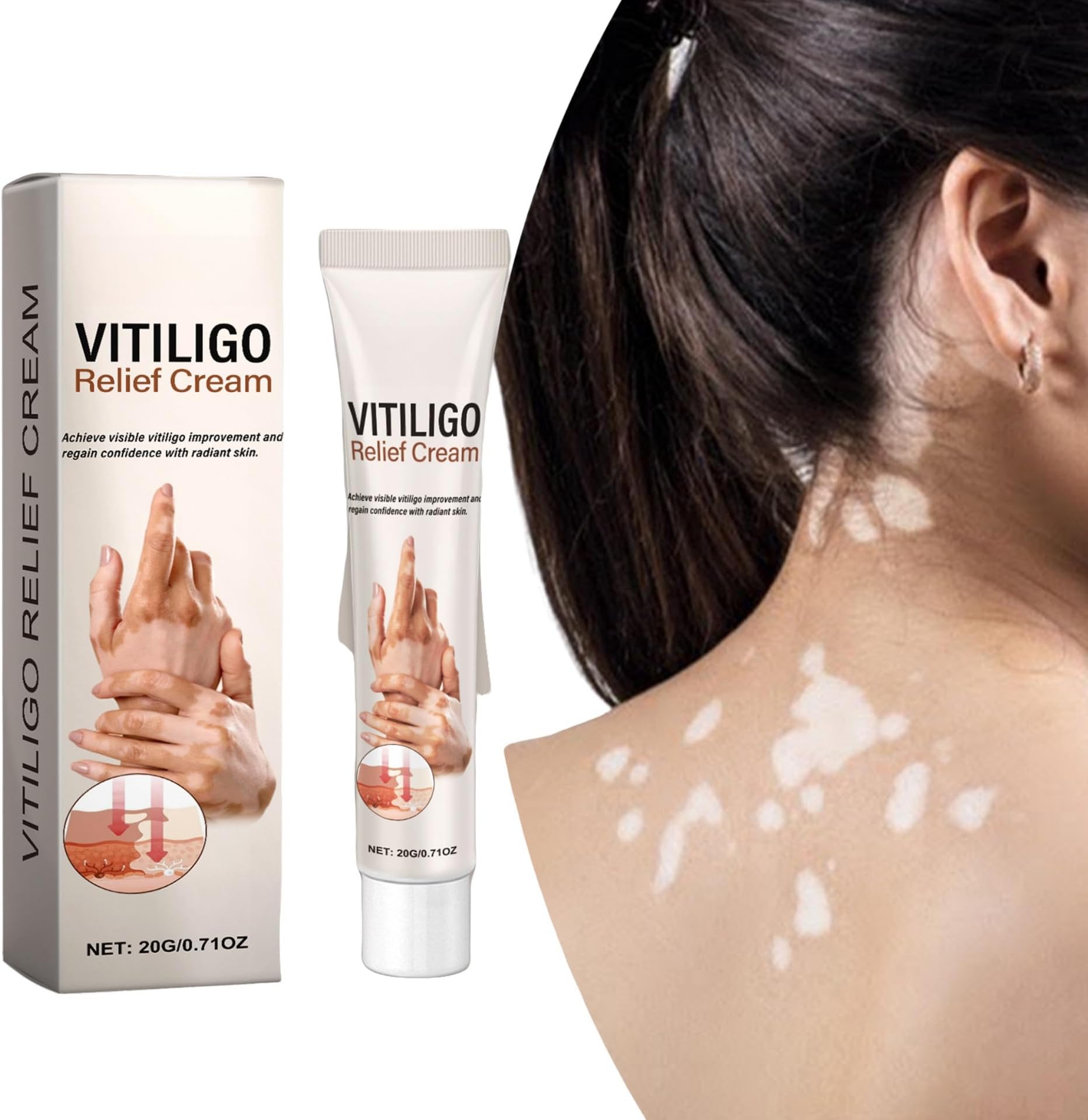Vitiligo Relief Cream 20g Skin Care Cream for Itchy Skin Relief, Hydrating Body Cream for Hands and Feet, Alleviates Discomfort and Soothes Dry Skin, Nourishing Formula for Skin Care