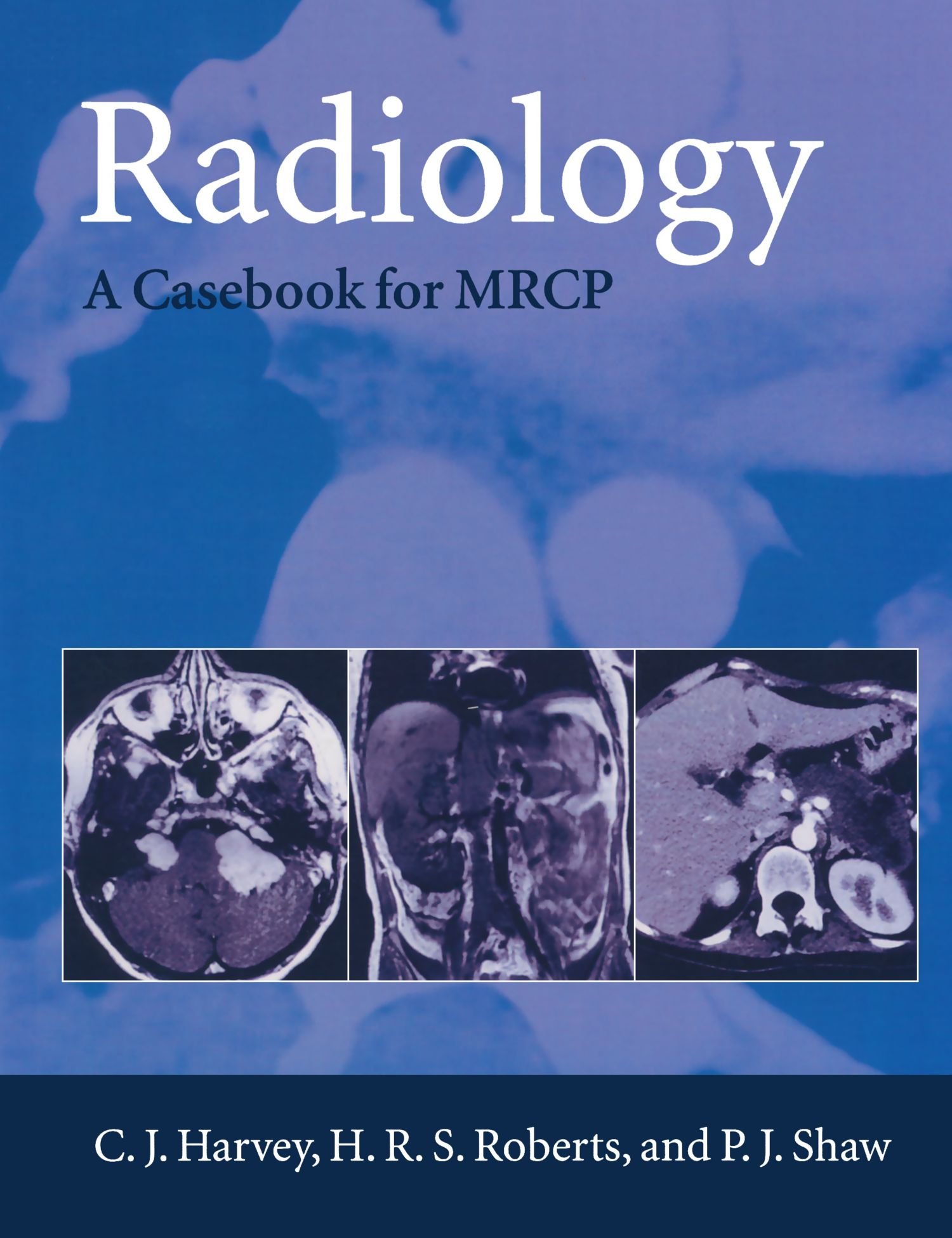 Radiology: A Casebook for M.R.C.P. (Oxford Medical Publications)