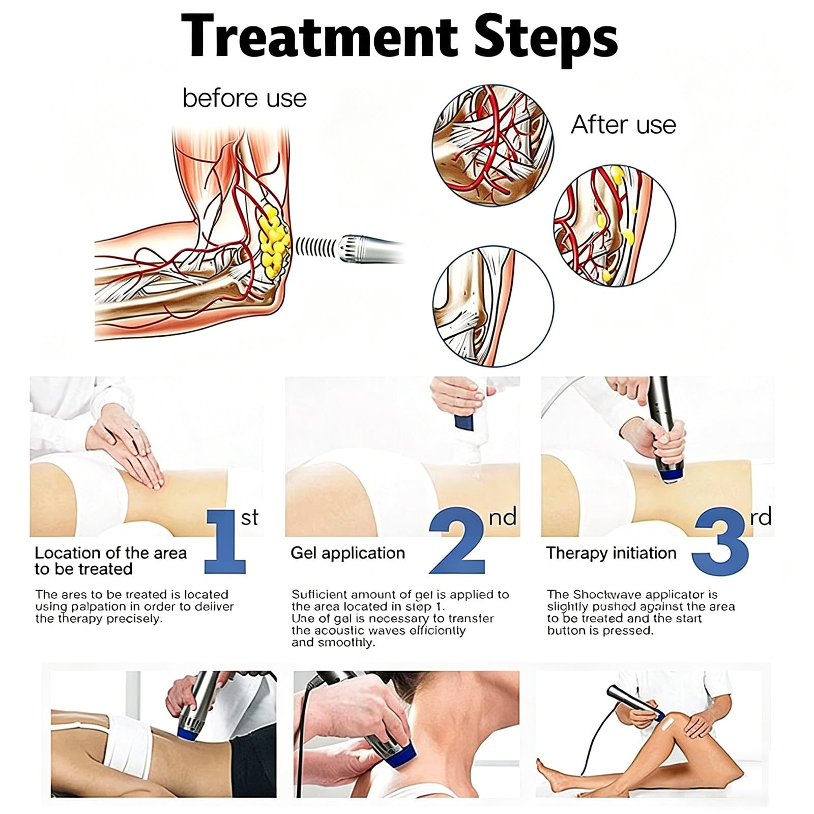 Apparecchio per terapia extracorporea a onde d'urto – Strumento di fisioterapia a onde d'urto elettromagnetiche, dispositivo per massaggio muscolare profondo per il sollievo dal dolore e il tratt