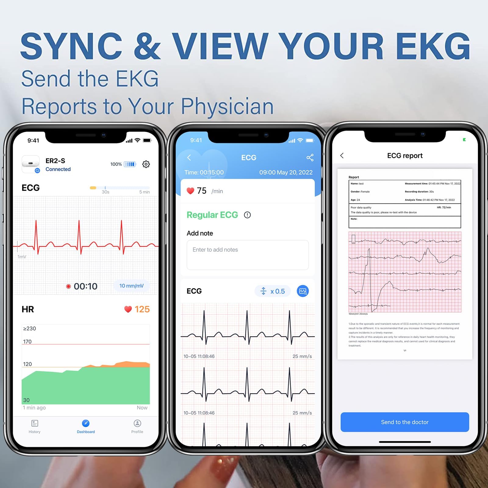 Wellue Mobiles EKG Gerät für Zuhause, Wireless Tragbarer EKG Gerät mit kleinem OLED Display, 30s - 5 Min Überwachung, Herzfrequenz & EKG Messung, kompatibel mit iOS & Android