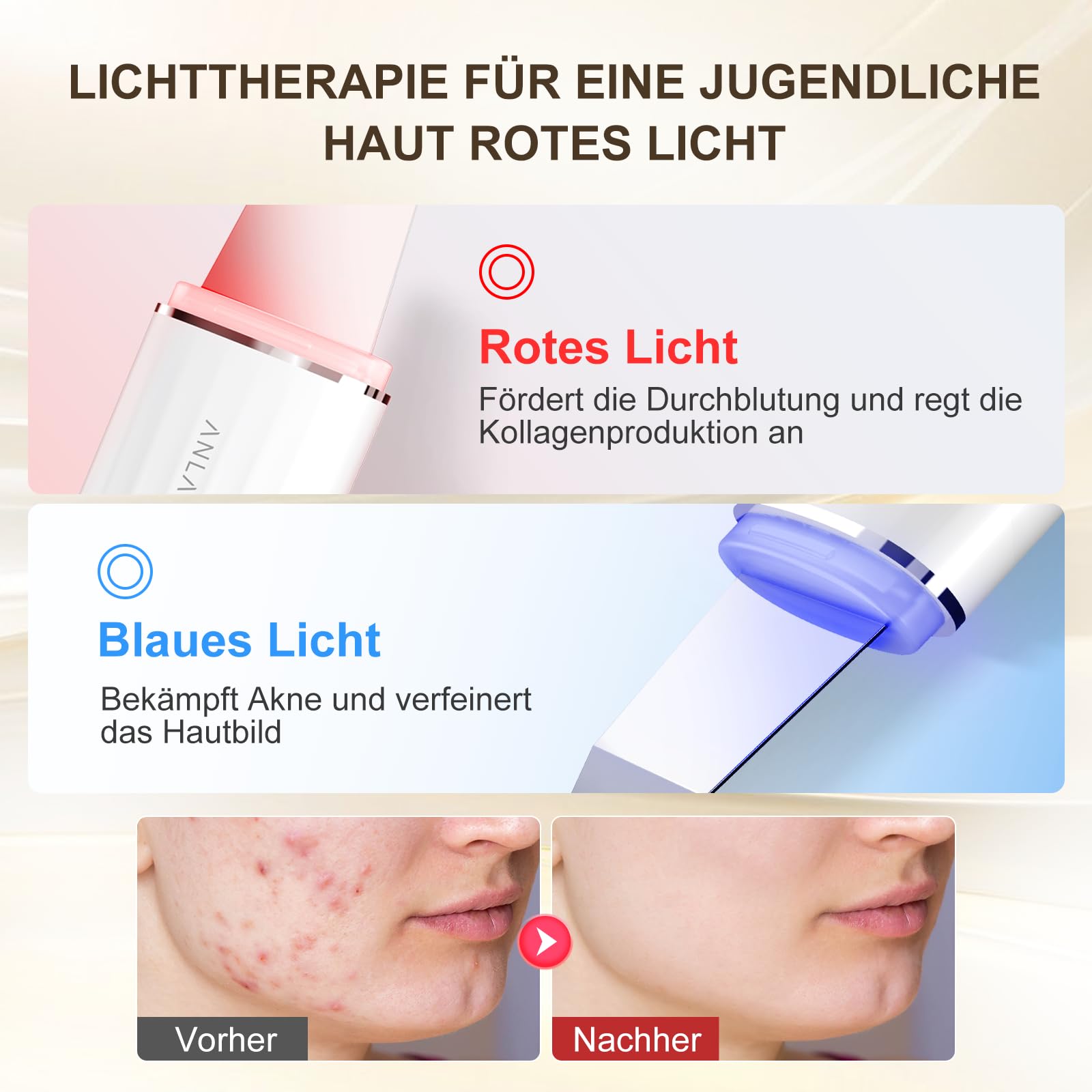Ultraschallpeelinggerät für Gesicht, ANLAN IPX7 Wasserdicht Ultraschall Skin Scrubber 6 in 1 Gesichtsreinigungsgerät Blau Rotlichtlampe Gesicht Porenreiniger mit Type-C Ladebasis
