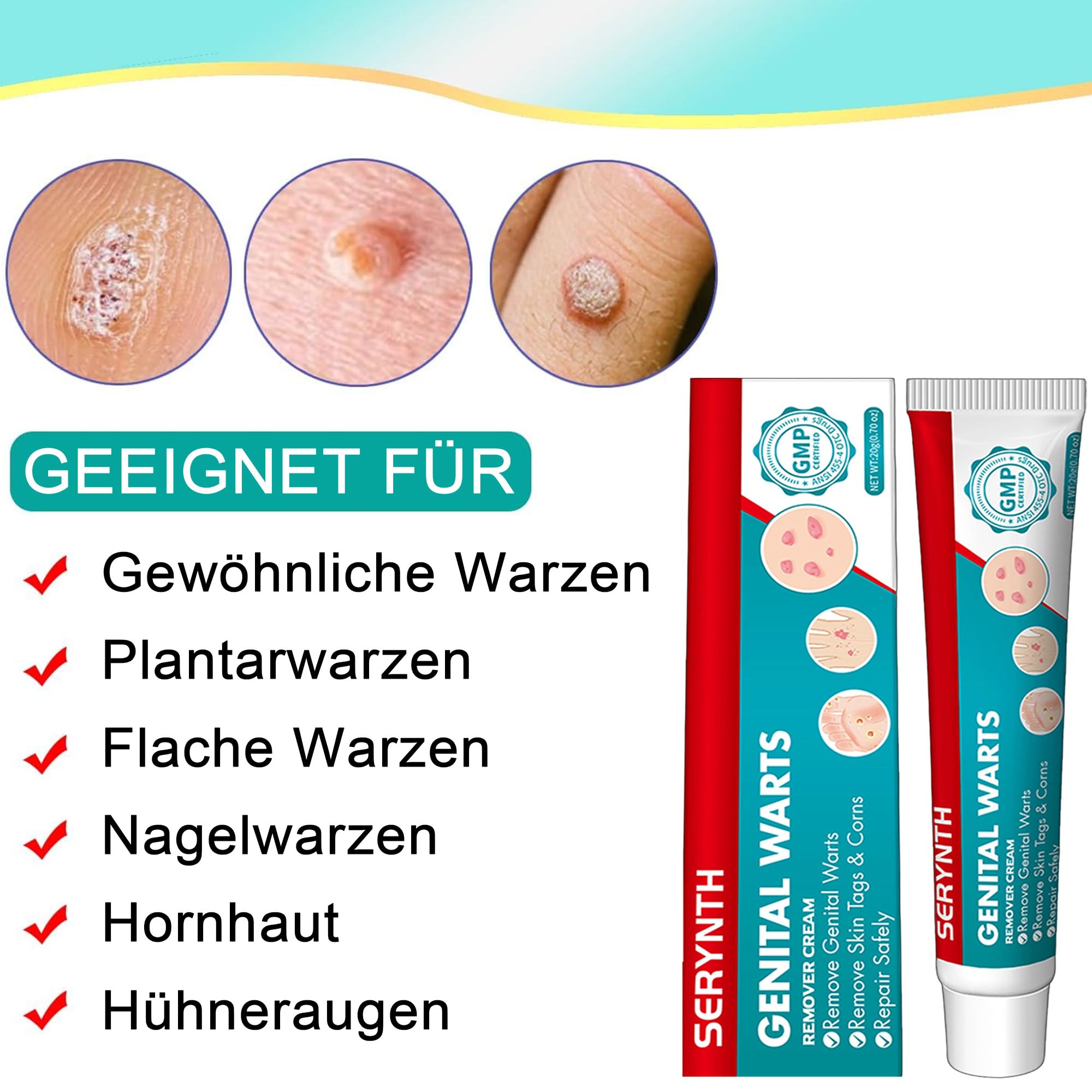 Warzenentfernercreme – geeignet für alle Hauttypen (20G)