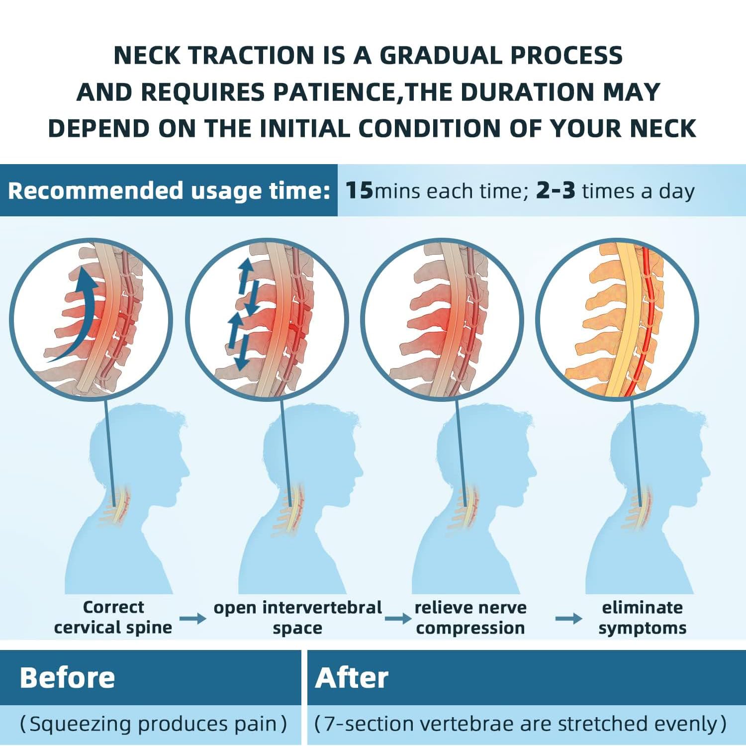 Dispositif de Traction du Cou Cervical,Orthèse de Col et Réglable,Collier Cervical Gonflable,Cervicale Soulage La Douleur for Distraktions Device,Outil de Thérapie de Correction D'étirement du Cou