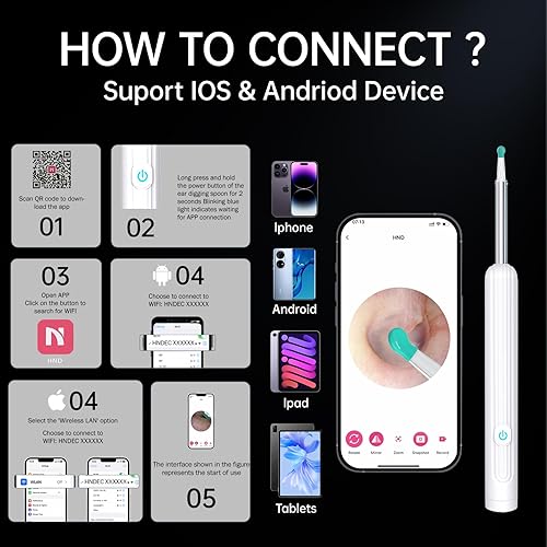 Miniatura 6 de Kit de eliminación de cera de oídos con cámara 1296P, herramienta de eliminación de cera de oído, kit de limpieza de oídos, limpiador de oídos con