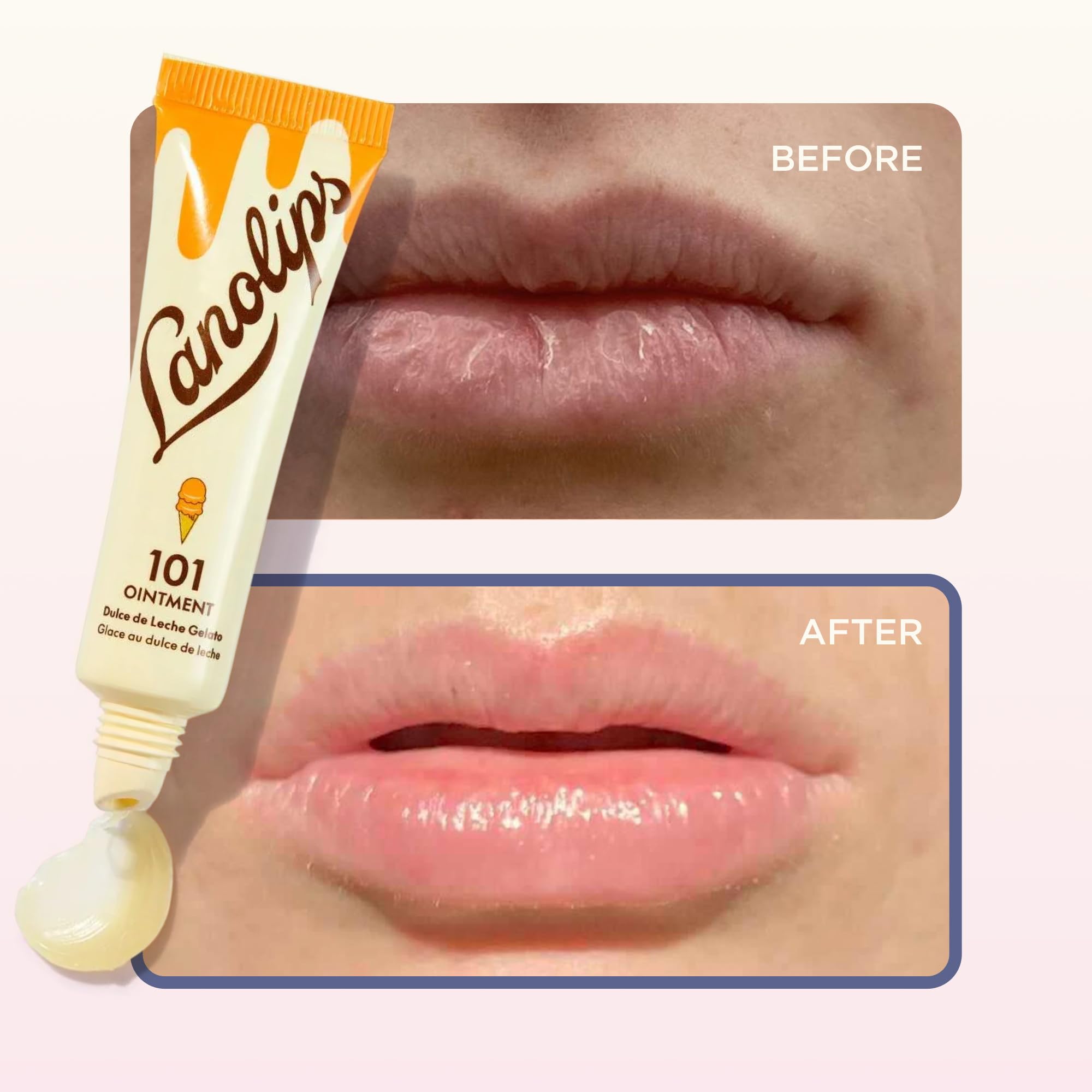Amazon.com : Lanolin 101 Multipurpose Ointment - Lanolin Lip Balm