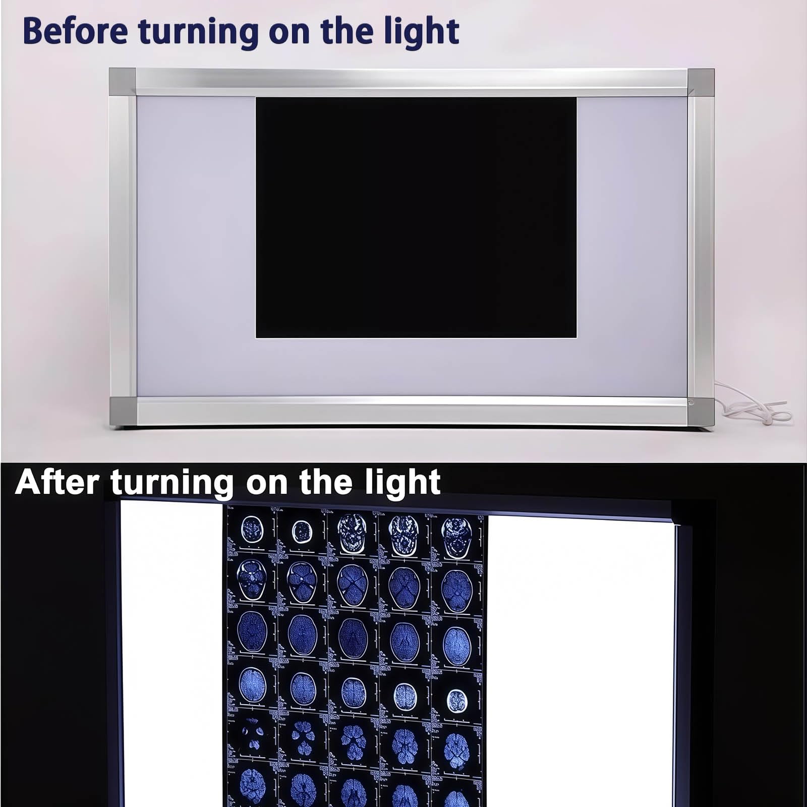 Iluminador LED de rayos X para montaje en pared, marco de aluminio ultrafino para clínicas dentales y ortopédicas, caja de visualización de películas portátil, solución de iluminación médica