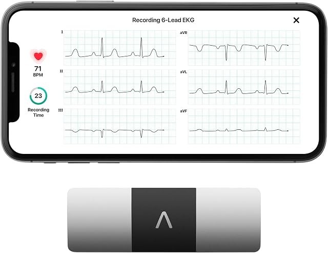 KardiaMobile 6L Personal EKG (ECG) Device and Heart Monitor - Six-Lead EKG Recording - Detect AFib - FDA-Cleared - by AliveCor