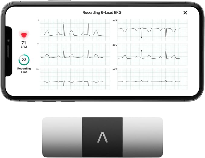 KardiaMobile 6L Personal EKG (ECG) Device and Heart Monitor SixLead EKG Recording Detect