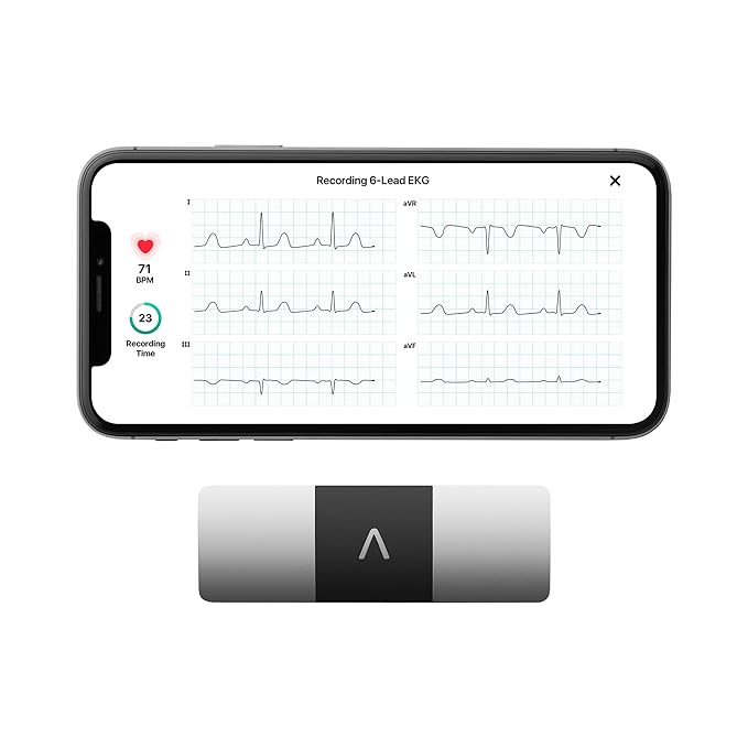 KardiaMobile SixLead Portable ECG Device Fast & Accurate 6 Lead ECG