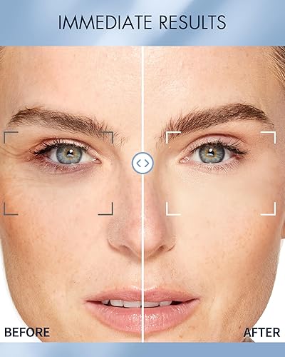 Miniatura 4 de PARCHE OJO NOCTURNO