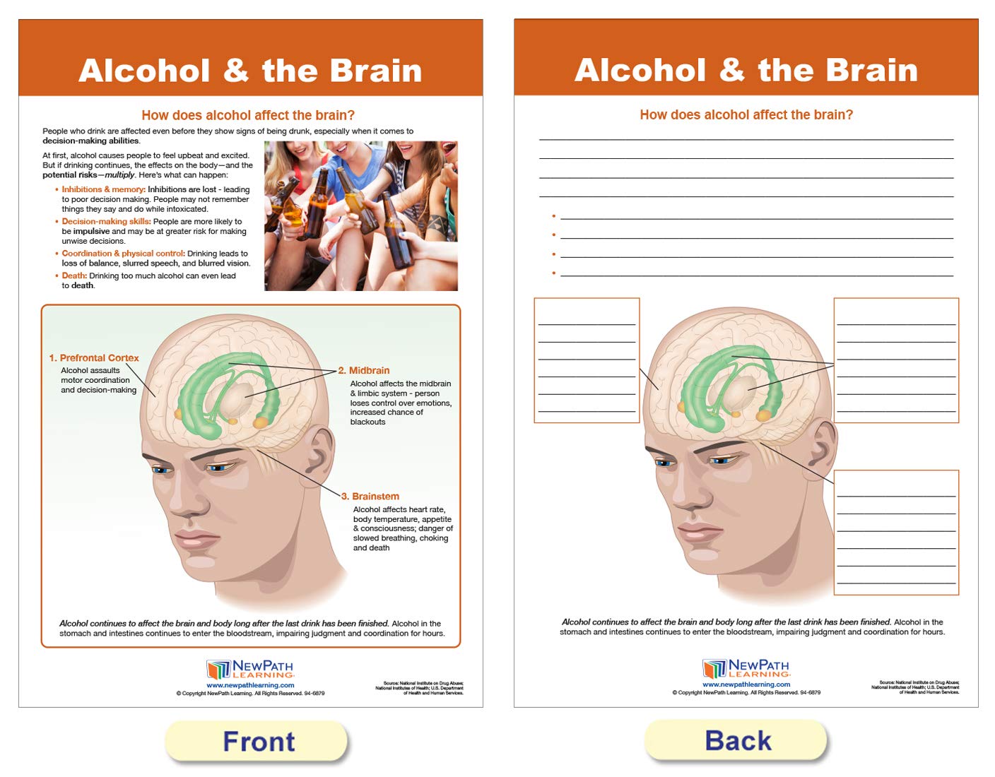 NewPath Learning Alcohol Abuse & Addiction Bulletin Board Charts, Set/7 - Laminated, Double-Sided, Full-Color, 12" x 18" (96-6006)