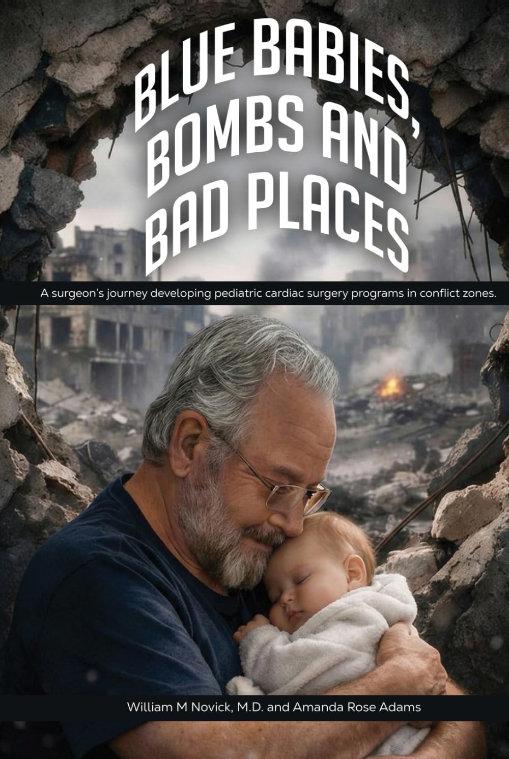 Blue Babies, Bombs and Bad Places: A surgeon’s journey developing pediatric cardiac surgery programs in conflict zones. Authors William M Novick, M.D. and Amanda Rose