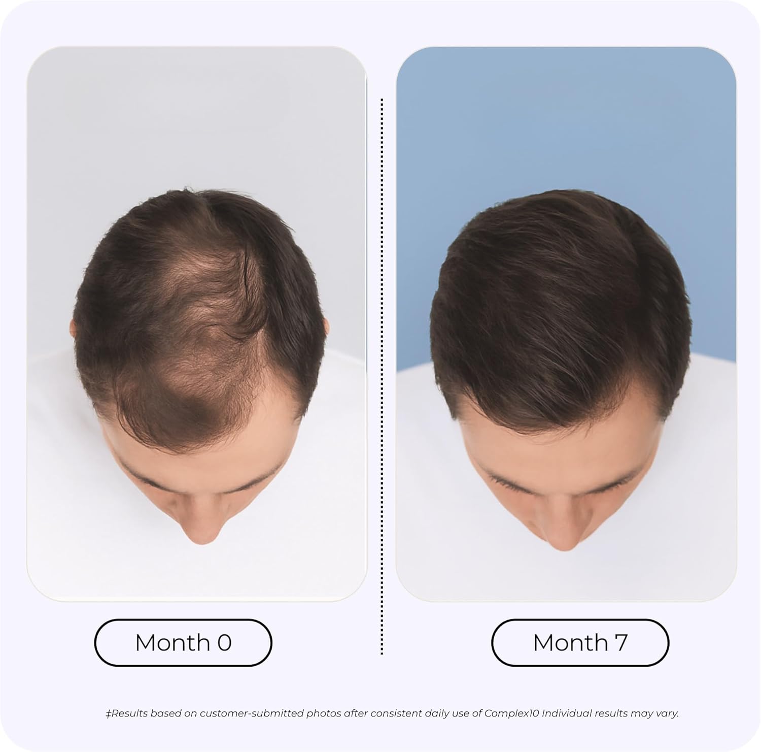 Complex10 Hair Support Supplement with Biotin, Collagen & 10 Essential Nutrients – Supports Healthy, Stronger-Looking Hair – 30 Capsules for Men & Women - Image 4