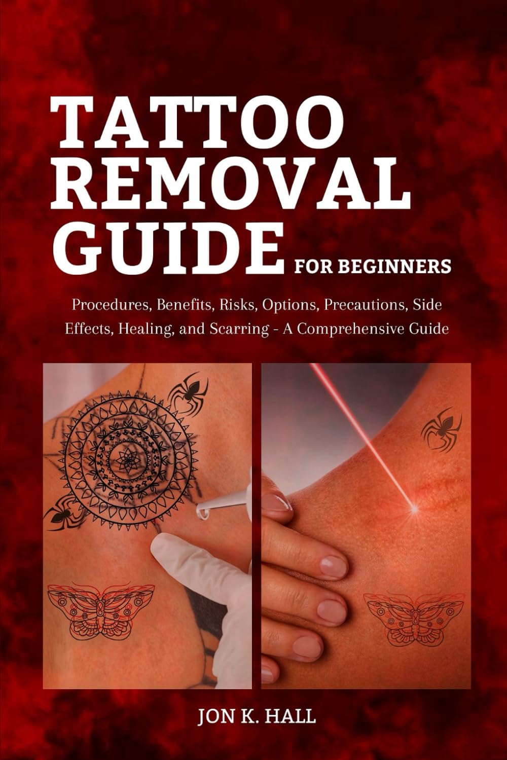 Tattoo removal guide for beginners: Procedures, Benefits, Risks, Options, Precautions, Side Effects, Healing, and Scarring - A Comprehensive Guide"