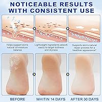 Vista 6 de Barra de cuidado de pies con urea 60% con 2% de ácido salicílico, crema hidratante para pies secos agrietados, rodillas, codos, manos, hidratante