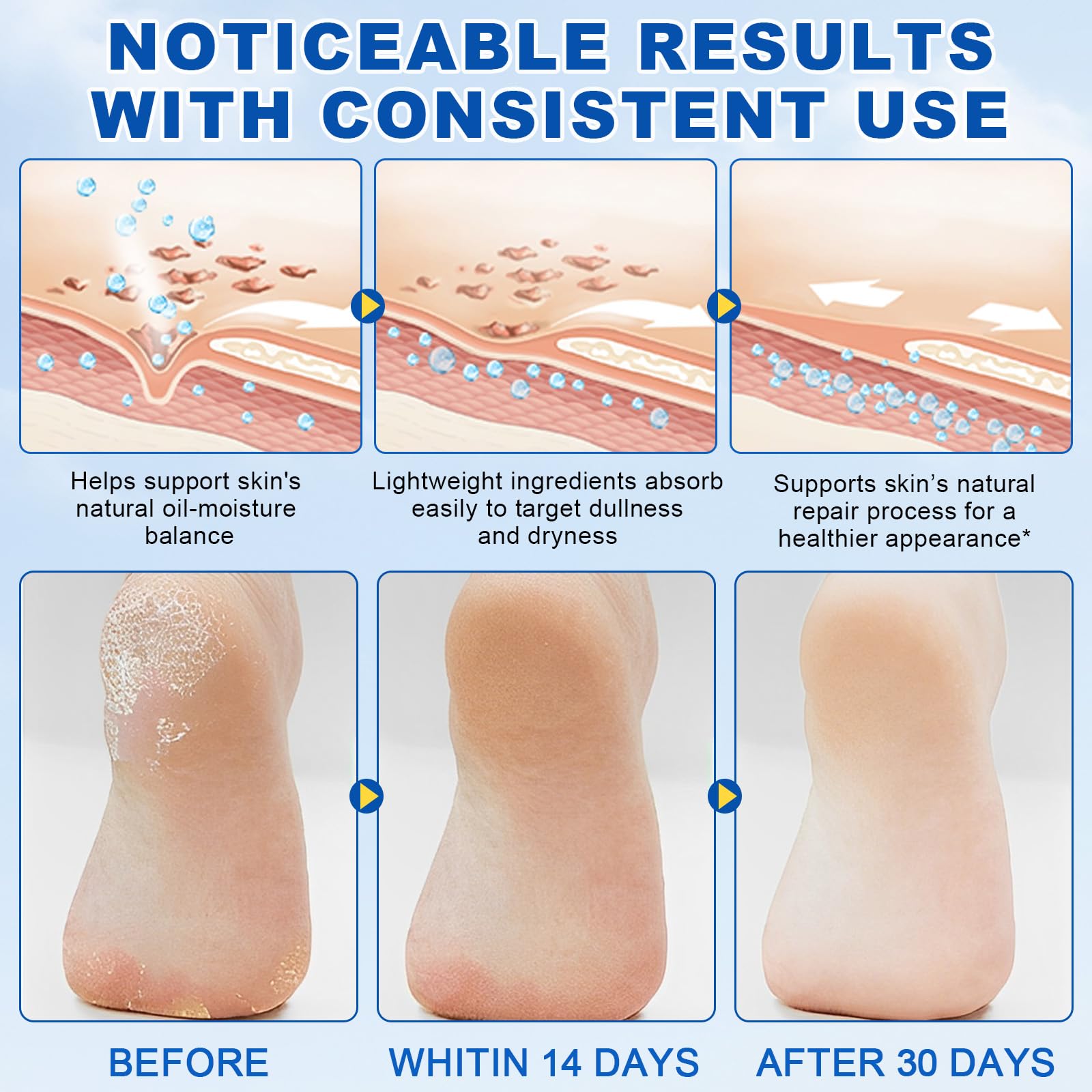 60% Urea with 2% Salicylic Acid Urea Foot Care Stick, Foot Cream Moisturizer for Dry Cracked Feet, Knees, Elbows, Hands,Moisturizes and Hydrates the Dry Skin,Callus Remover & Skin Softener -1.41oz