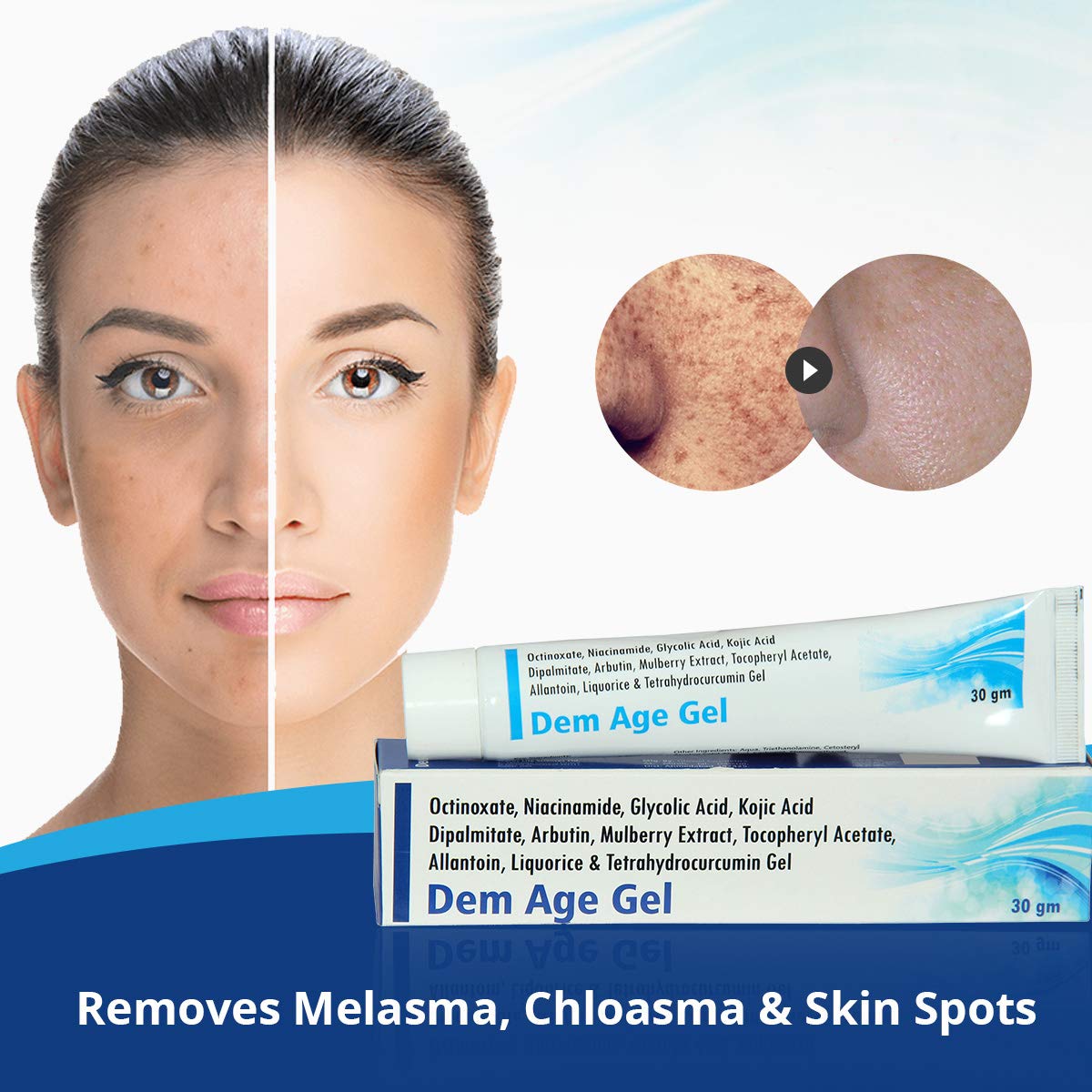 octinoxate melasma
