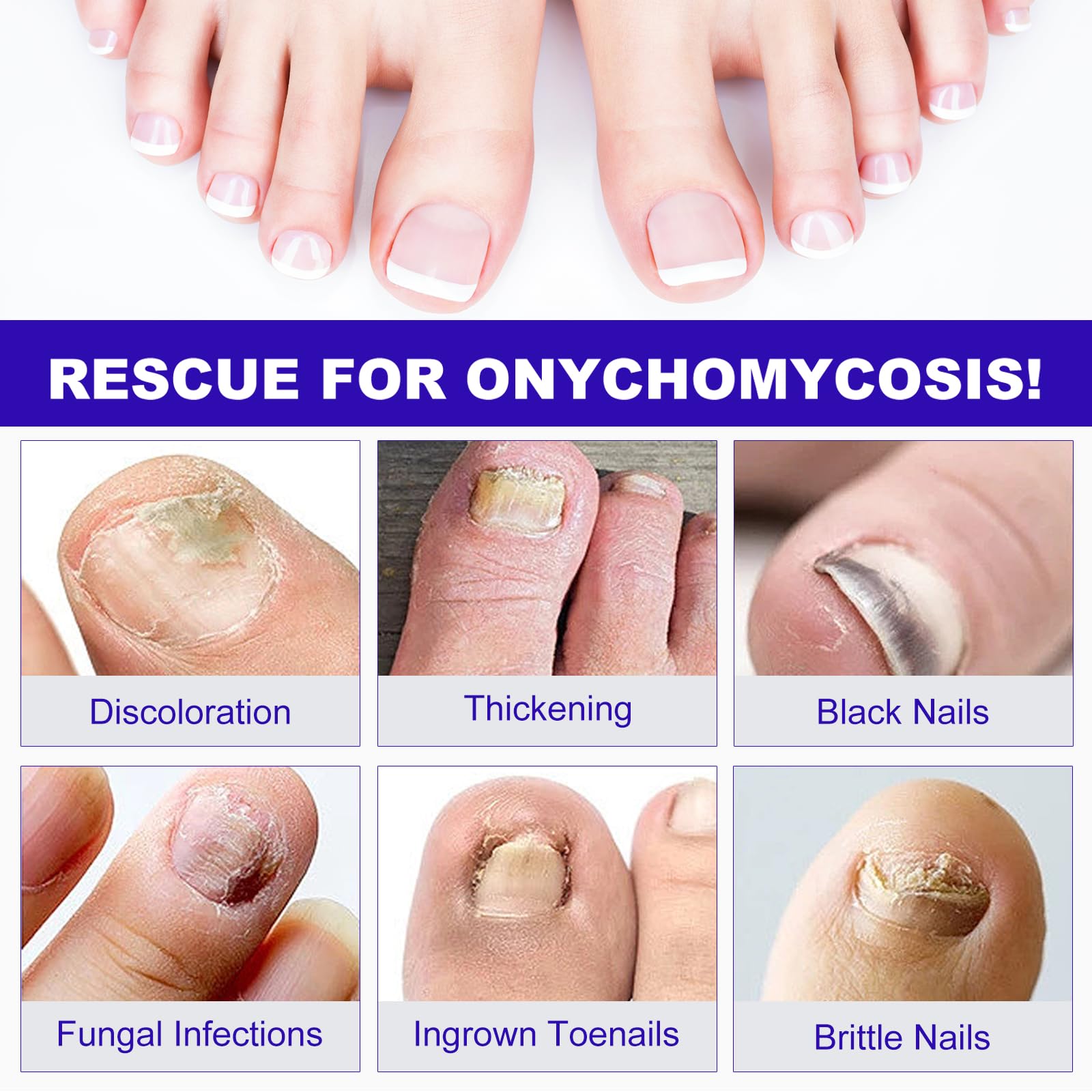 Ninsiec Fungal Nail Patches - Nighttime Toe Funqus Patches,Discolored &Thickened Nails Repair, Treatments for Damaged Nails 24 Pcs - Image 3