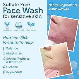 Era Organics Manuka Honey Face Wash for Sensitive Skin - Sulfate Free Gentle Cleanser with Organic Aloe Vera, Hyaluronic Acid & More - Soothing & Moisturizing for Dry Skin - Made in USA (4 oz)