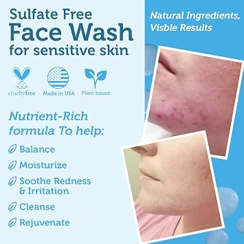 Era Organics Manuka Honey Face Wash - Gentle Cleanser for Sensitive Skin