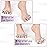 Dr. JK- ToePal Gel Toe Separator, 4 Pairs, Toe Spacers, Bunion Corrector, Blue & Clear