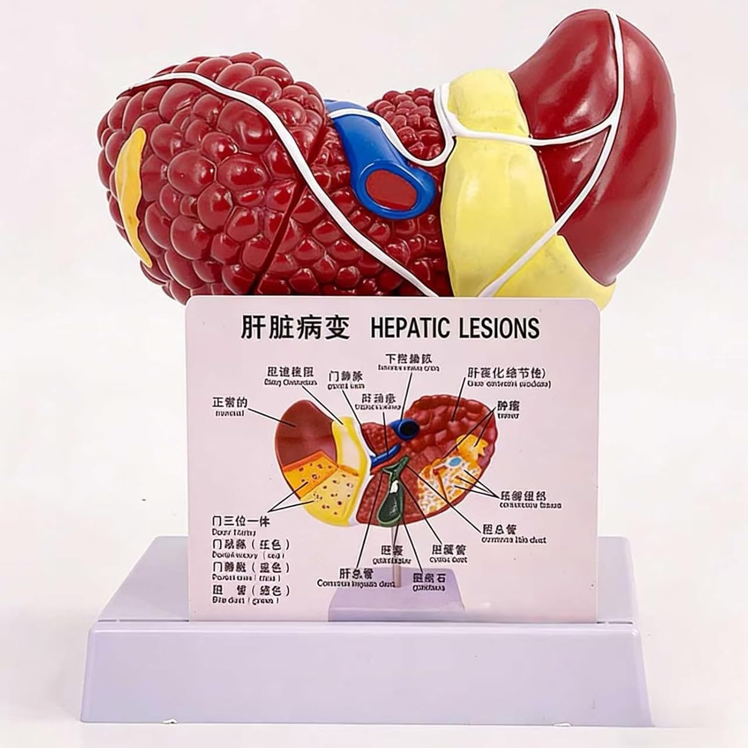 Life Size Anatomy Liver Model with Display Base, Simulated Human Liver Anatomy Model, Hilar Gallbladder Bile Duct Structure for Digestive System Organ Demonstration Teaching Aids