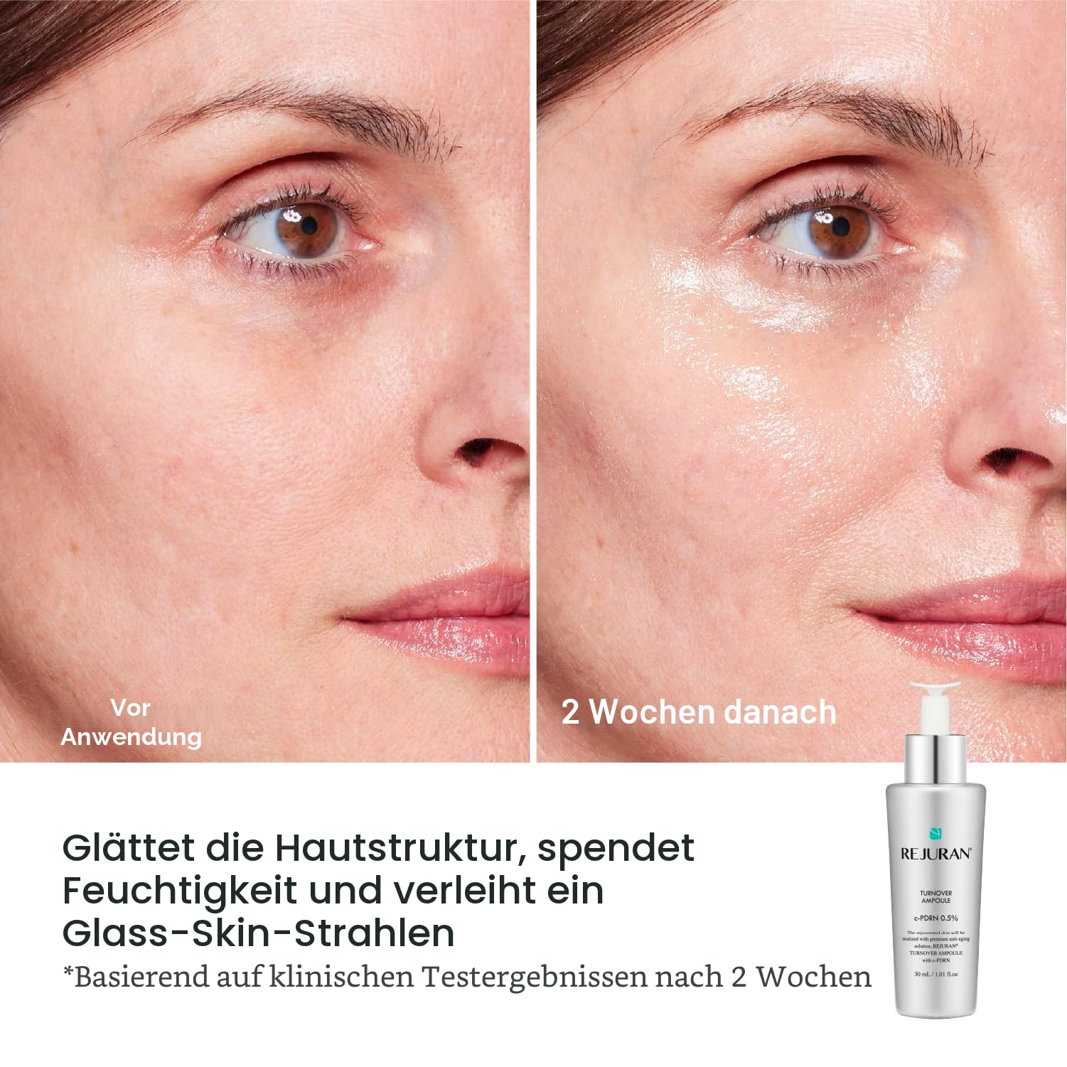 REJURAN Turnover Ampoule, C Pdrn Original Salmon Dna Pdrn Gesichtsserum Für Verjüngung, Straffung, Feuchtigkeitsversorgung Und Jugendlichen Teint, 1,01 Fl Oz (1Er Pack)