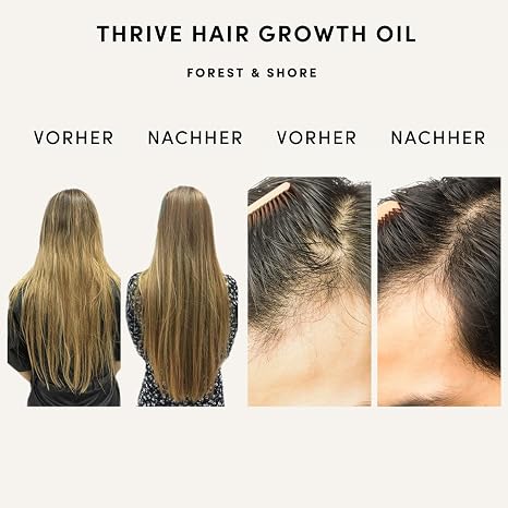 natural hair oil for hair growth accelerate with organic rosemary oil castor oil almond oil and argan oil as hair mask and hair treatment (hair growth oil)